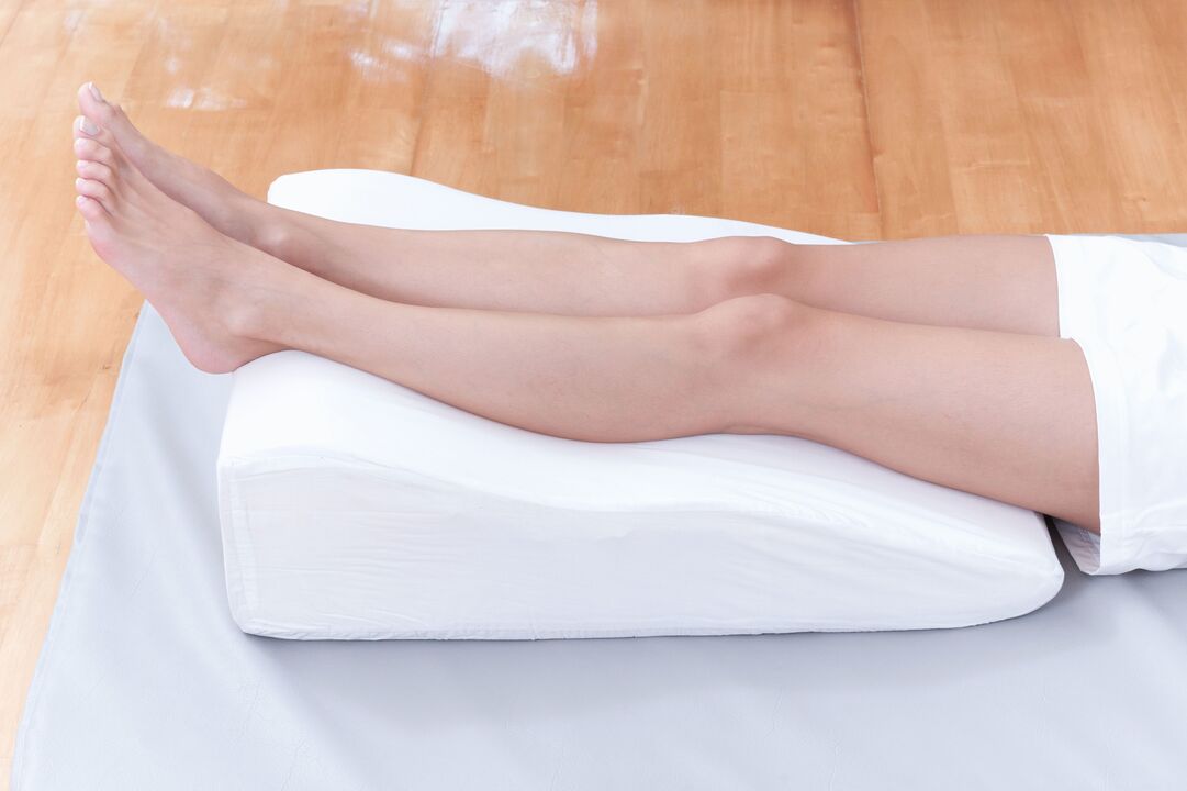 Varicose vein prevention