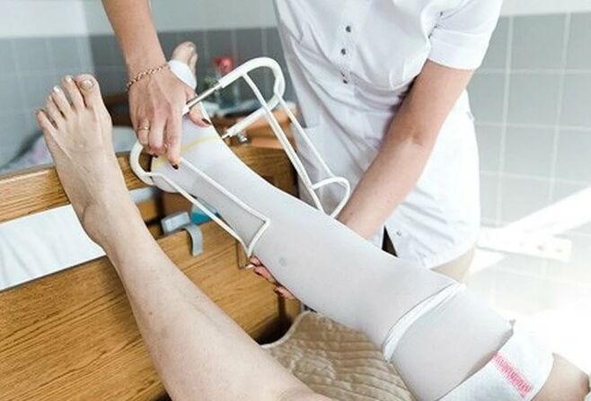 Postoperative time from the operation in the veins of the legs