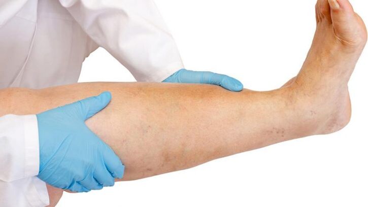 how to recognize the disease